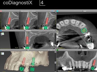 coDiagnostiX™